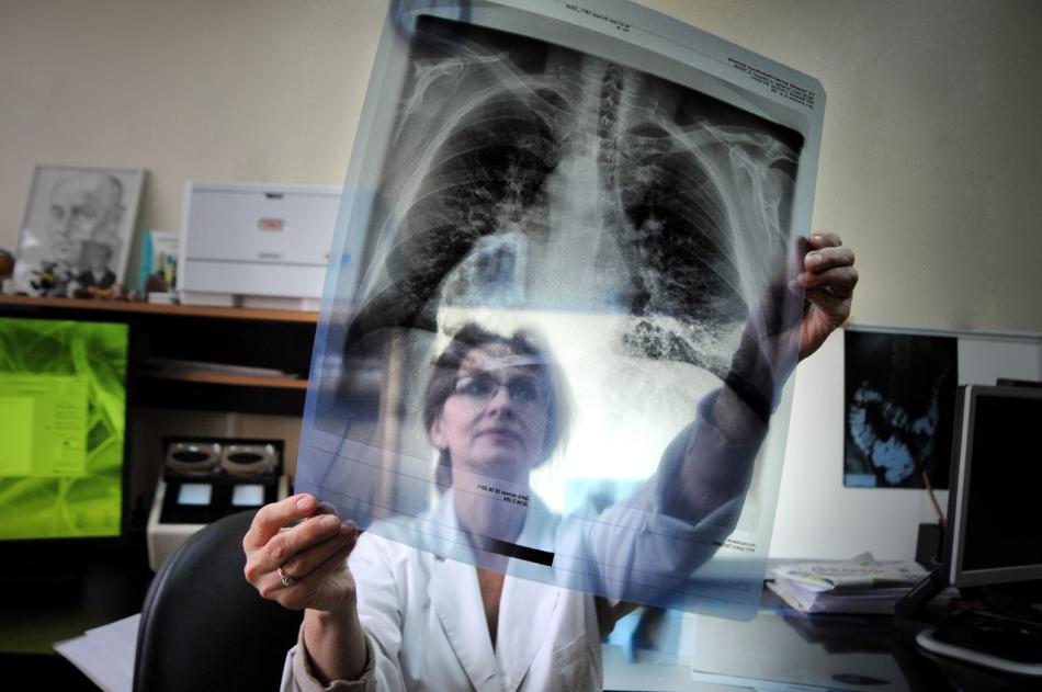 Туберкулез и его профилактика